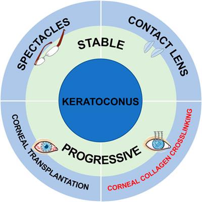 Recent advances in medicinal compounds related to corneal crosslinking